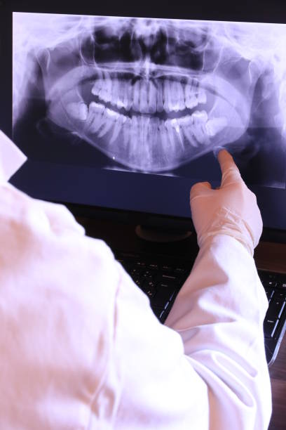 Best Emergency Tooth Extraction in Monona, IA